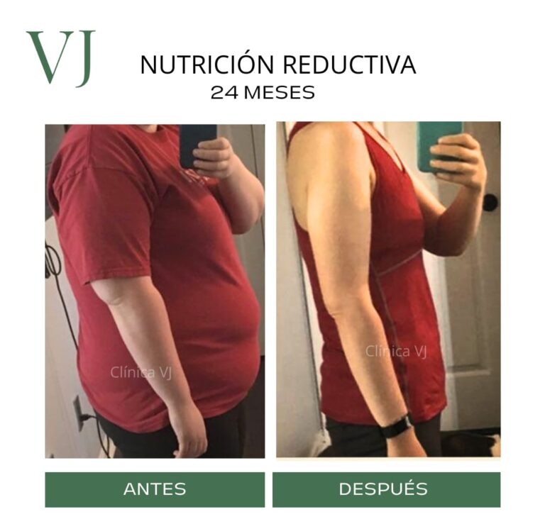 Nutrición clínica en puebla por Spa VJ