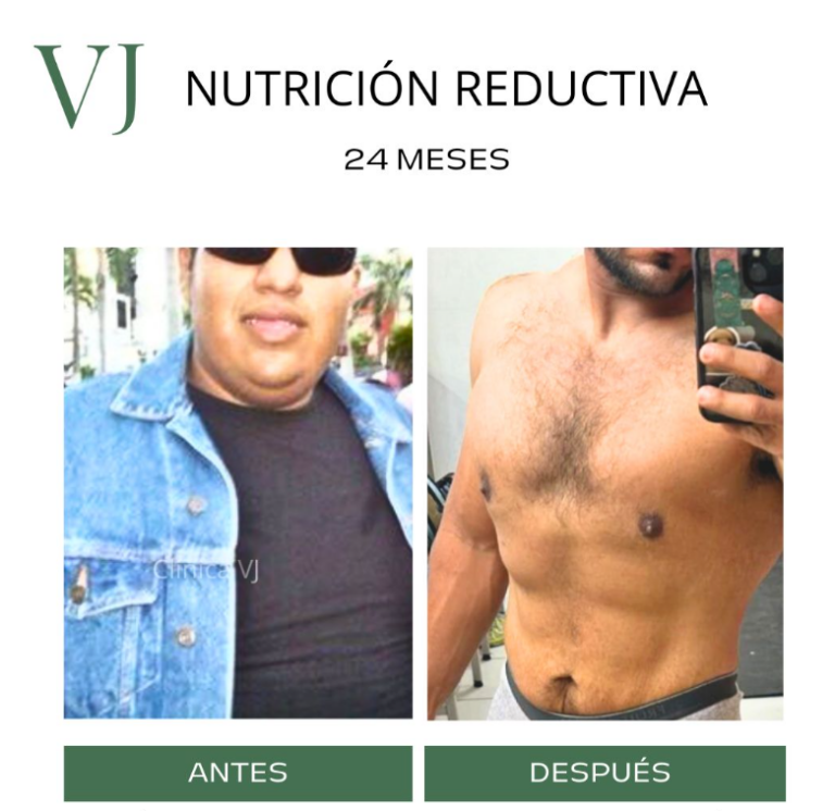 Nutrición clínica en puebla por Spa VJ