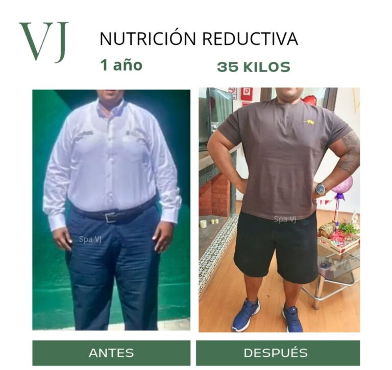 Nutrición clínica en puebla por Spa VJ