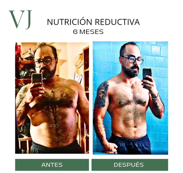 Nutrición clínica en puebla por Spa VJ