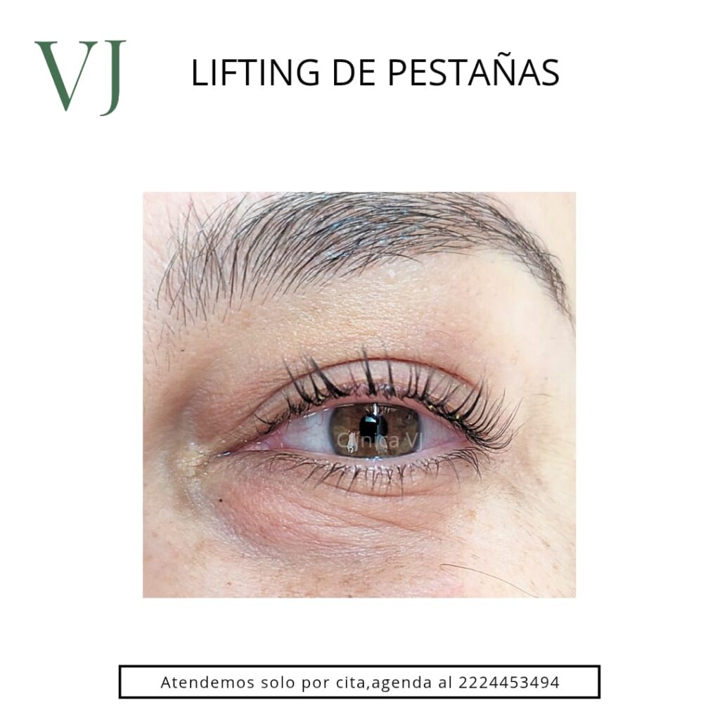 tratamientos esteticos en puebla